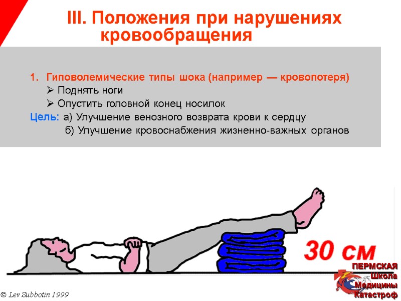 III. Положения при нарушениях   кровообращения © Lev Subbotin 1999